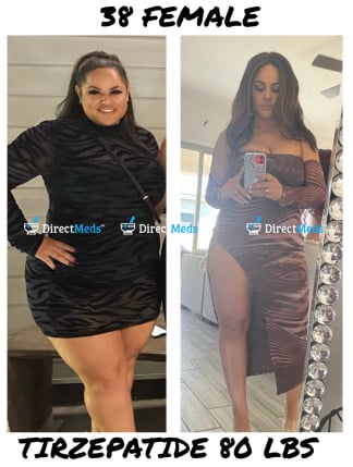 Direct Meds reviews 1